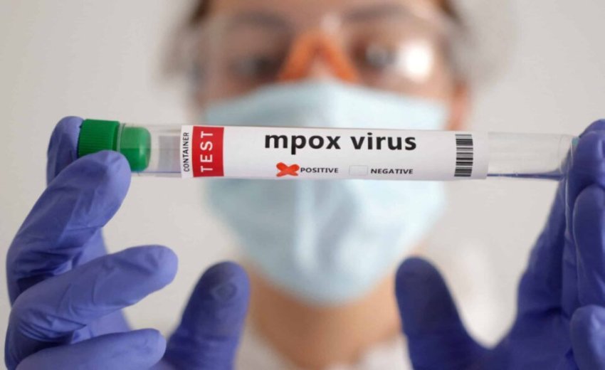 zbulohet nje rast i ri i variantit mpox clade ib ne britanine e madhe 67f60f877b281