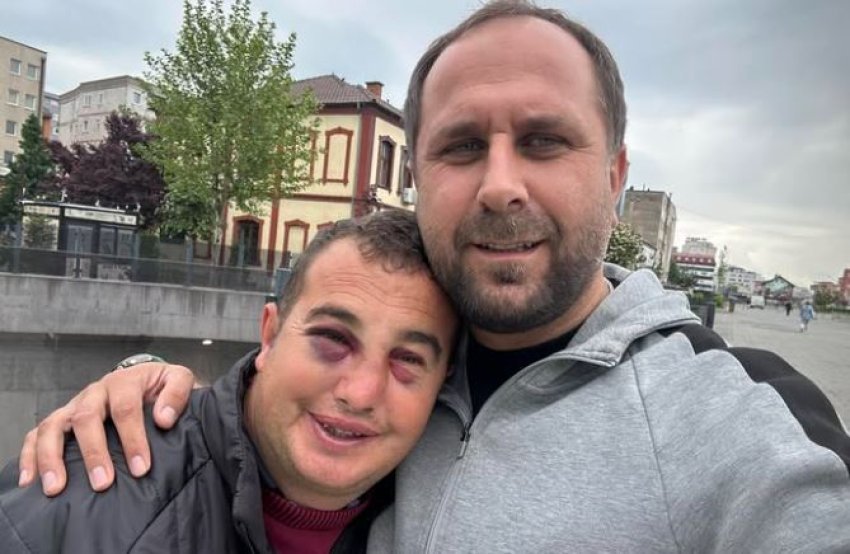 flet kujdestari i cufes qe u sulmua ne ferizaj tregon si ka ndodhur ngjarja 6822e311e757a