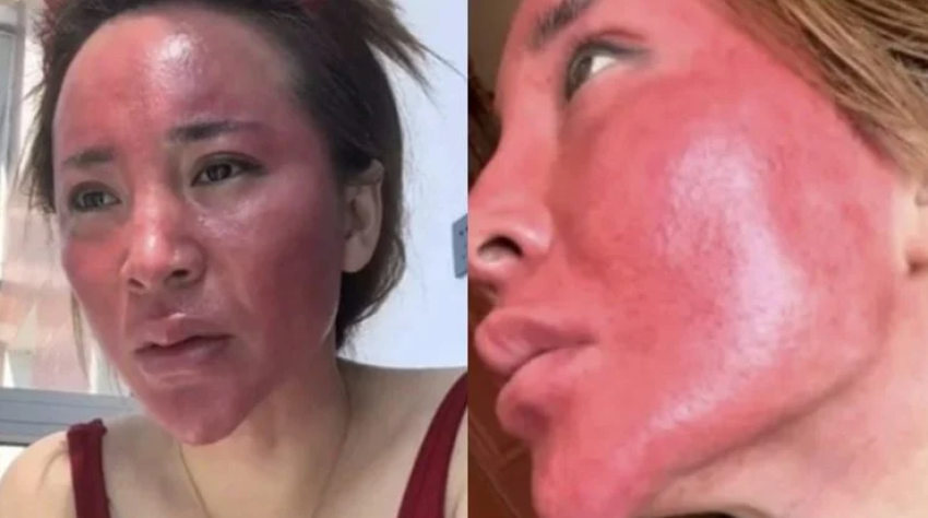 historia e pazakonte e grimit gruaja me skuqje te rende ne fytyre pretendon se nuk ka hequr grimin per 22 vite 686ece8970c10