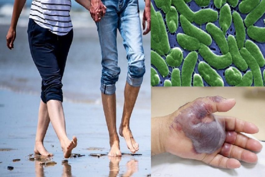 kater te vdekur ne florida nga bakteret qe hane mish 687a87e9d410d