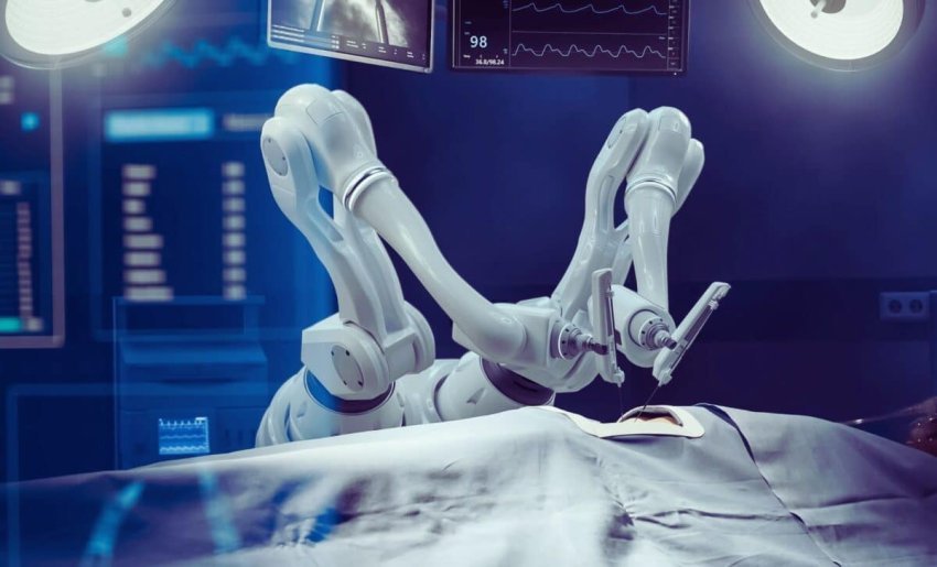 per here te pare roboti kryen nje nderhyrje kirurgjikale pa ndihmen e njeriut 6871f5fe4b277