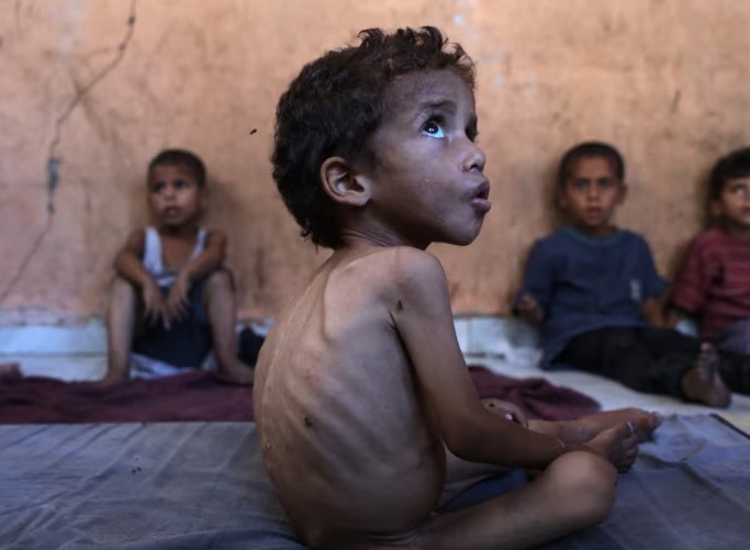 amnesty international akuzon izraelin se qellimshem po shkakton uri ne gaza 68a2fbc98a1b0