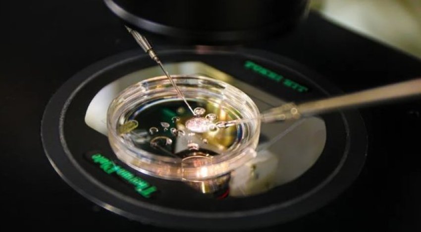 Shkencëtarët krijojnë embrione nga ADN-ja e lëkurës njerëzore 1 shkencetaret krijojne embrione nga adn ja e lekures njerezore 68dc32b8d54ef