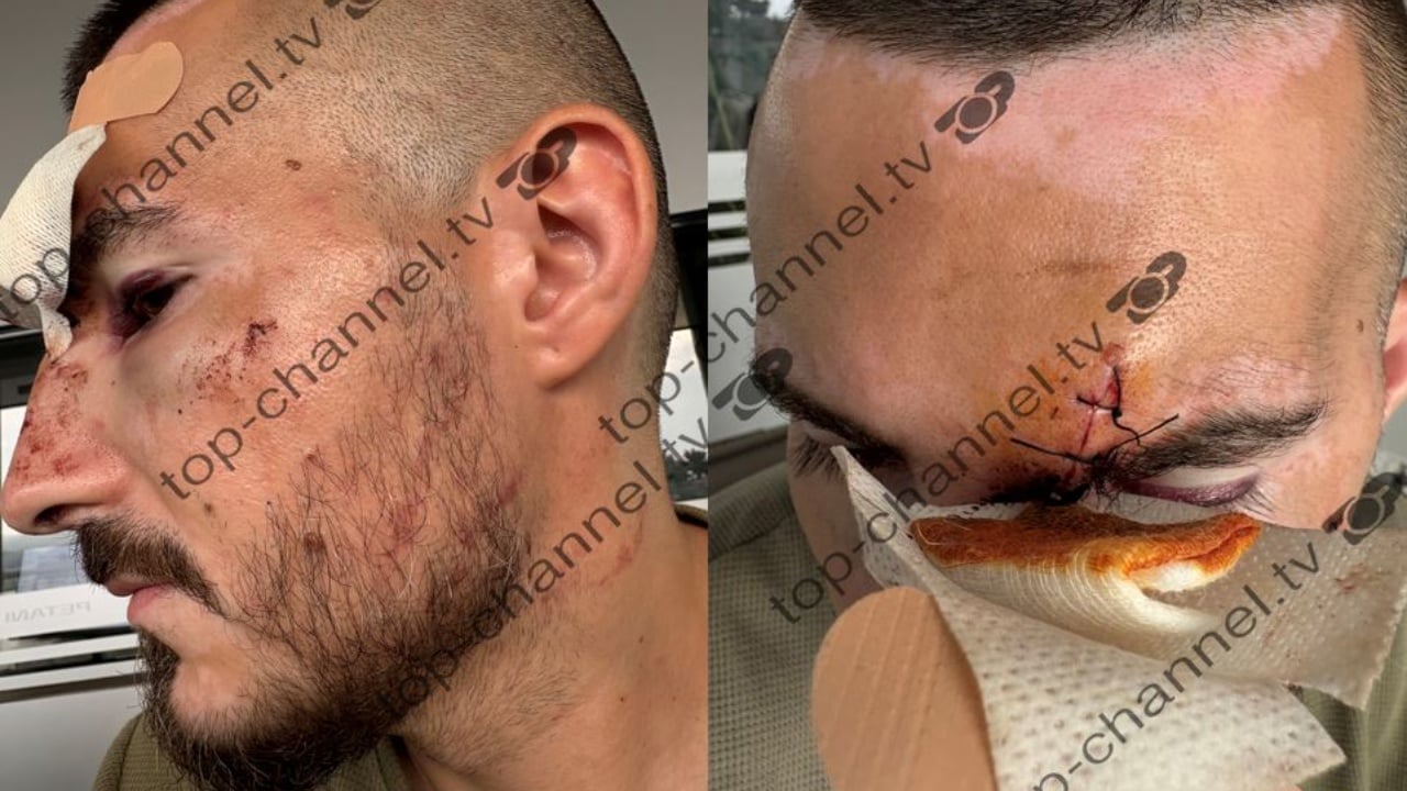 turisti denoncoi ne tch sulmin dhe grabitjen nga pese persona reagon policia e durresit per rastin jane ndaluar dy minorene 68b5f7034495f