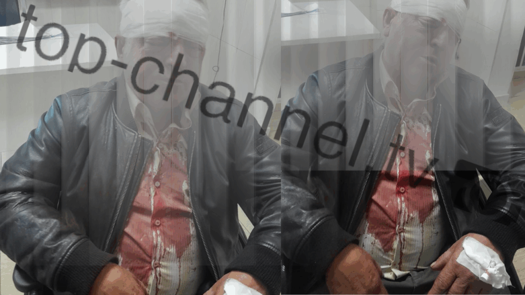 dhunuan me sende te forta 61 vjecarin arrestohen dy autoret e dyshuar rezultuan me precedente penale 68e810055fd90