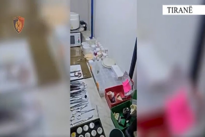 operacioni dentistry sekuestrohen 300 shishe me produkte me afat te skaduar ne tirane 68f2469475e70