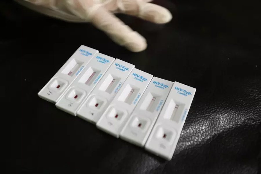 obsh jep alarmin gjysma e diagnozave te hiv ne europe zbulohen shume vone 69285b8247222