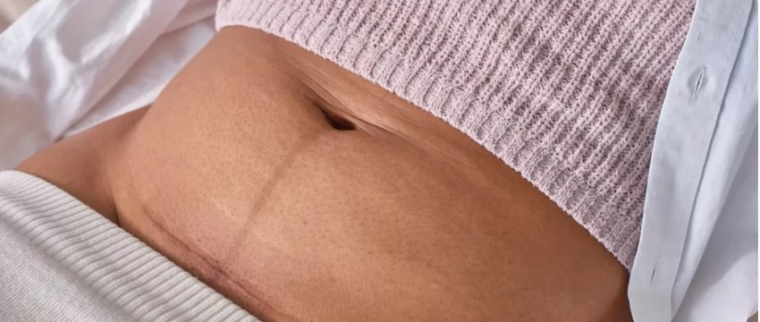 si ndodh rikuperimi pas prerjes cezariane oret ditet dhe javet pas lindjes 6918373273b60