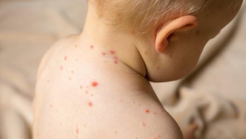 18 raste me fruth ne shqiperi pergjate vitit 2025 6952f496c93a7