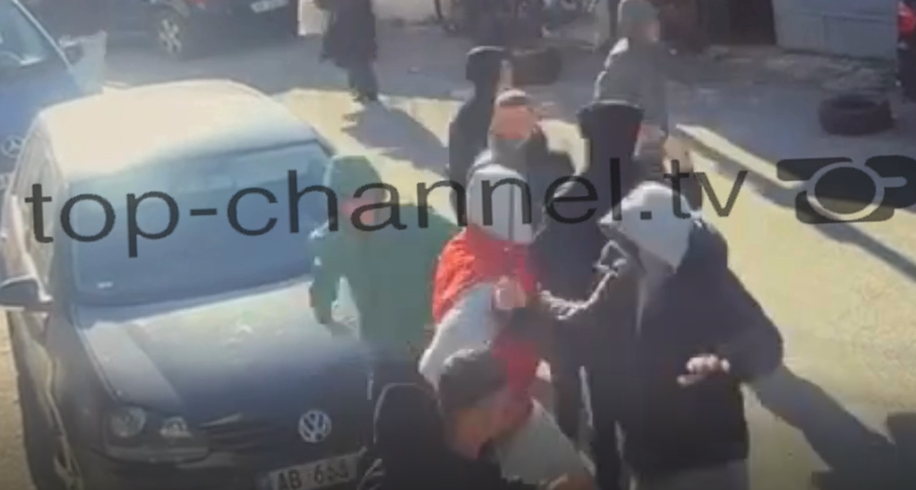 pamje te renda del video nga sherri mes te miturve ne shkoder tre te plagosur me thike 693c1bb378d0a