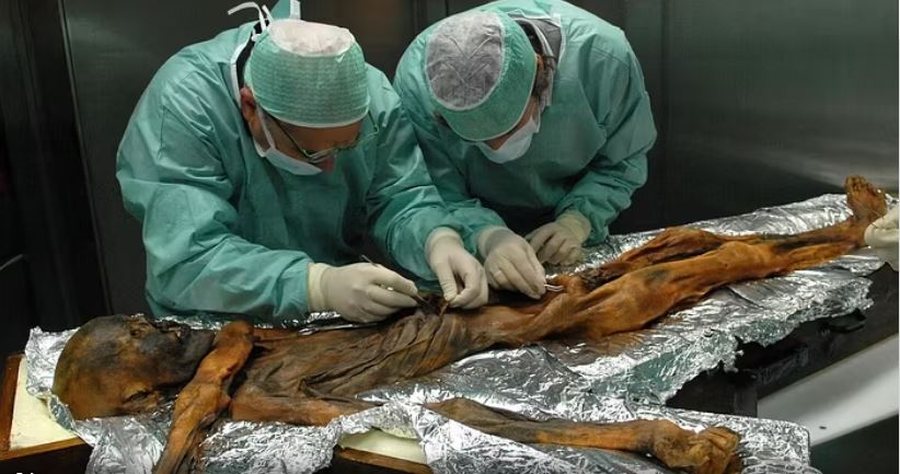 zbulohet se mumia otzi ishte e infektuar me papilloma virus 69505904201d0