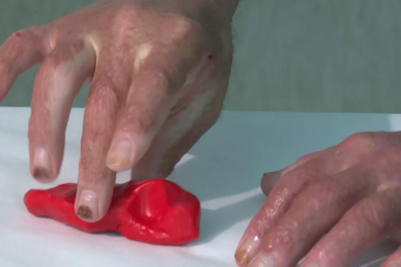 ferr i perditshem per te lenduarit ne kocan shume prej tyre ende trajtohen fale donacioneve 695d569bde3ad