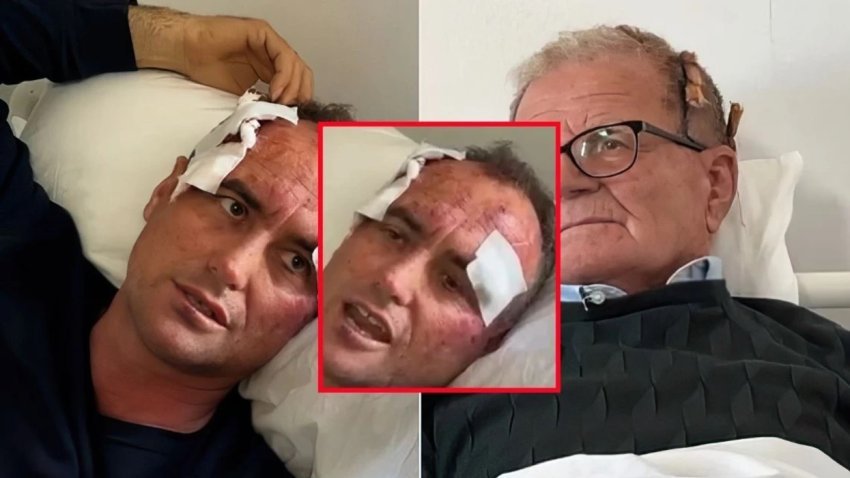 je bere shume e bukur mergimtari rrihet nga polici ne fier se i komentoi se motres 6963dfd5dcd02