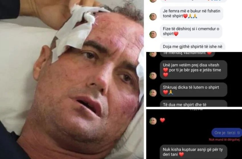 je femra me e bukur ne fshatin tone shpirt motra e policit nxjerr mesazhet e 46 vjecarit qe tha se u rrah per nje like 696a9376d763a