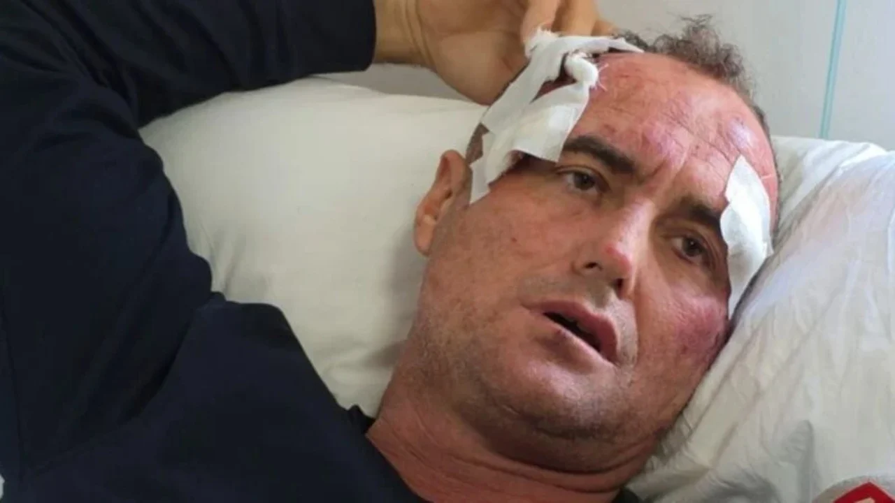 me dhunuan ne shtepine time njerez me uniformen e policise reagon serish 46 vjecari nga fieri dua drejtesi 696bc9e450bef