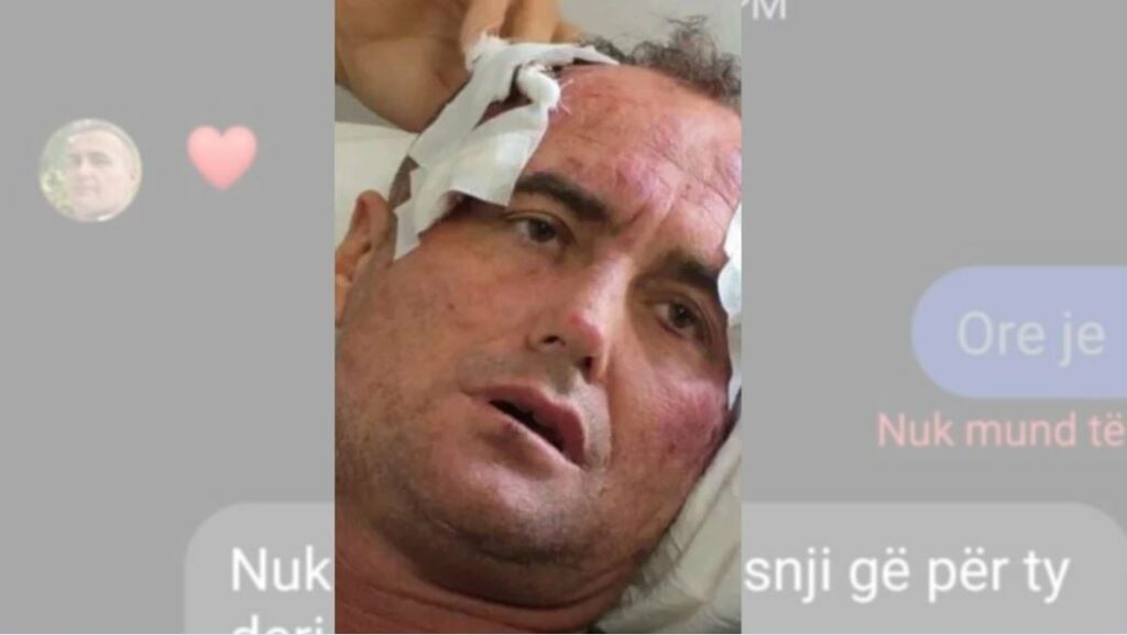 mos ki frike nga une te pres ne vjose zbulohen mesazhet ja cfare i shkruante 46 vjecari motres se policit ne fier te deshiroj si i cmendur pse i the fredit 696a5c4378692