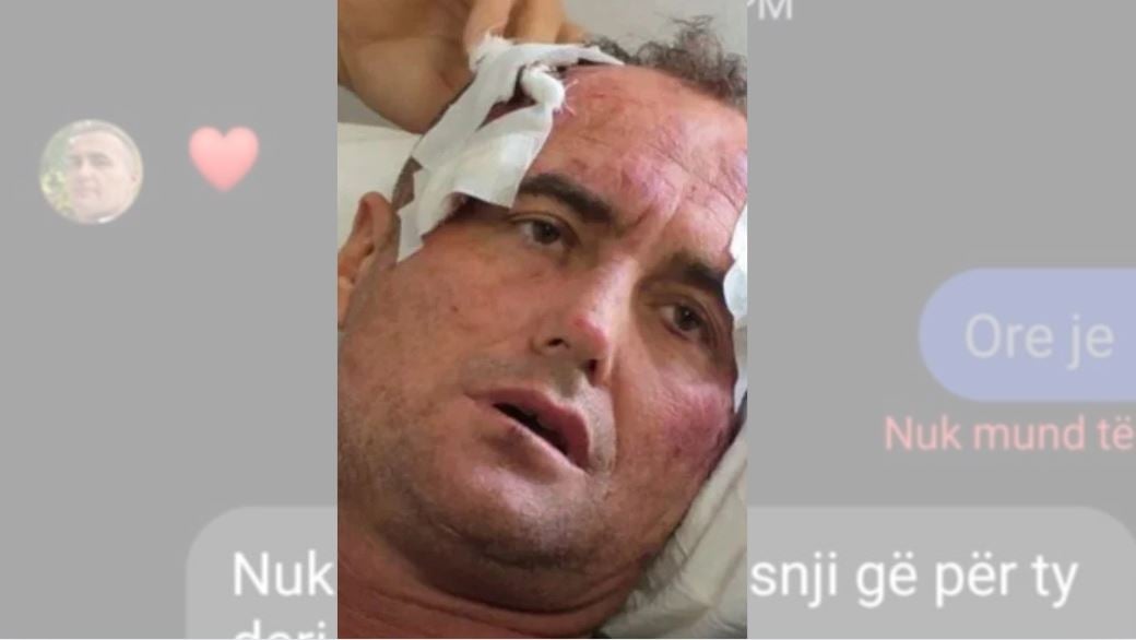 mos ki frike nga une te pres ne vjose zbulohen mesazhet ja cfare i shkruante 46 vjecari motres se policit ne fier te deshiroj si i cmendur pse i the fredit 696a5c4378692