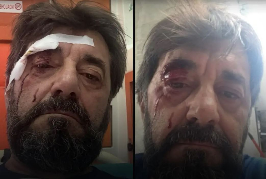 dhunimi i ilir demaliajt identifikohet dhe shpallet ne kerkim autori i dyshuar zbardhet deshmia e analistit 6a44ff305eafc