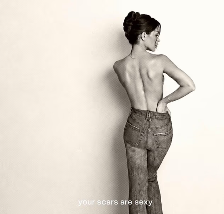 e dashura e cruz beckham pozon topless per te treguar shenjen e operacionit ne shtyllen kurrizore 6a49f1fca8b2b