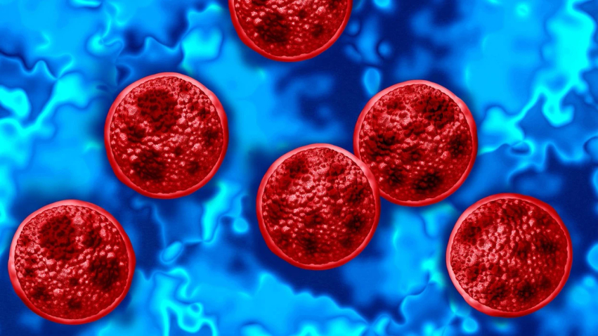 Çfarë është Cyclospora? Dy vdekje në SHBA, shpërthimi i sëmundjes e vë Evropën në gatishmëri 3 cfare eshte cyclospora dy vdekje ne shba shperthimi i semundjes e ve evropen ne gatishmeri 6a7307f0252ea