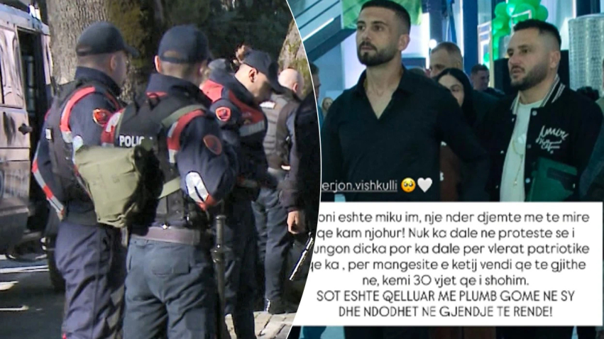 bes kallaku reagon pas plagosjes se mikut te tij ne proteste dyshohet se u godit ne sy me plumb gome 6add2d6fd4681