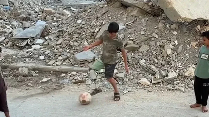 humbi kemben ne sulm 13 vjecari nga palestina vazhdon te luaje futboll me proteze 6ac1793579524